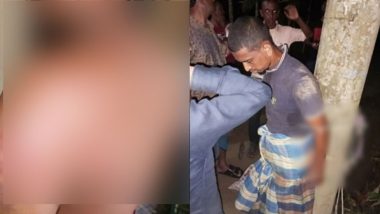 কুলাউড়ায় প্রতিবন্ধী যুবককে চো র সন্দেহে পিটিয়ে জখম