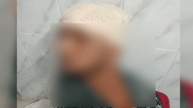 মাধবপুরে বন প্রহরীকে কুপিয়ে জখম