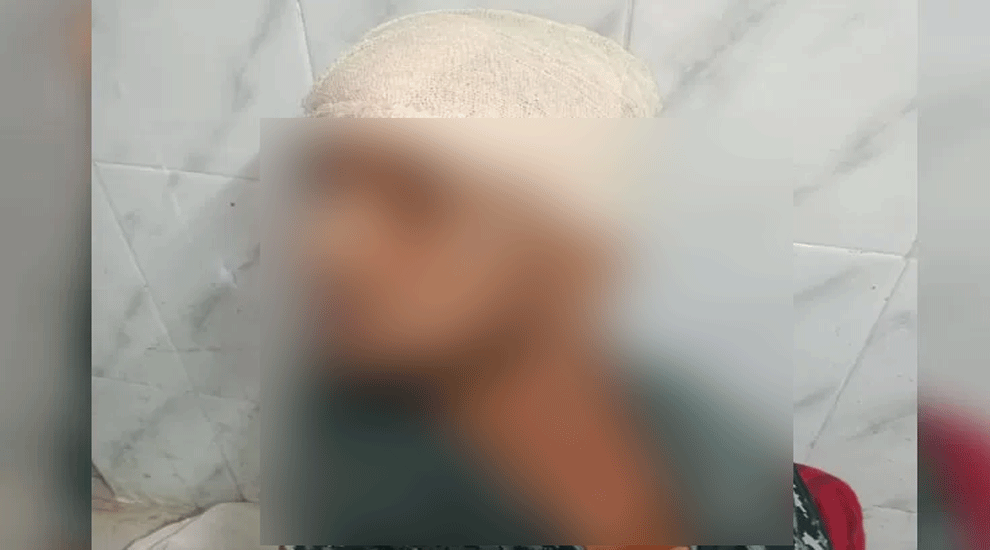 মাধবপুরে বন প্রহরীকে কুপিয়ে জখম
