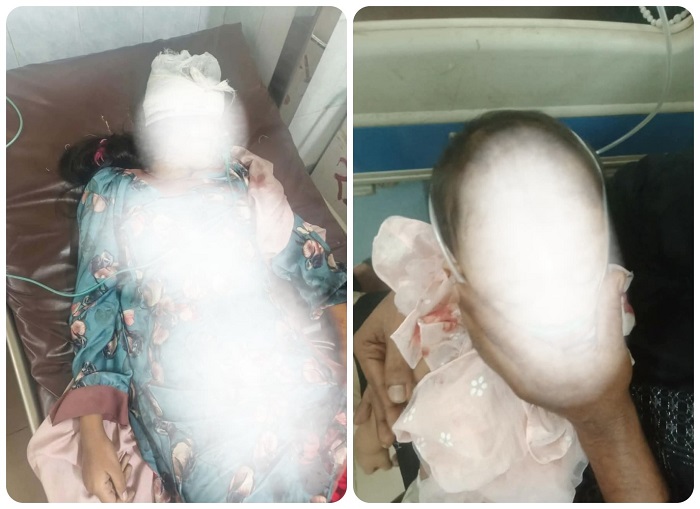 সিলেটে সাদাপাথর বাসের ধাক্কায় প্রাণ গেল মা-মেয়ের