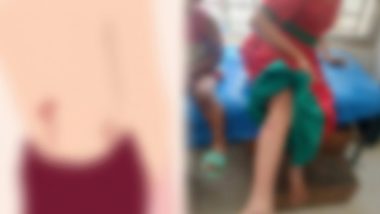 হবিগঞ্জে পাগলা কুকুরের কামড়ে স্কুল ছাত্রীসহ আ হ ত অর্ধশত